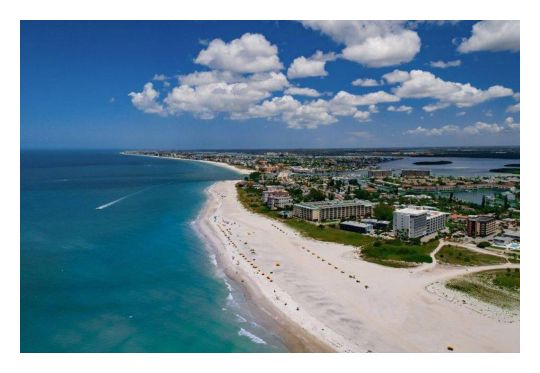 Treasure Island Florida Luxury Homes